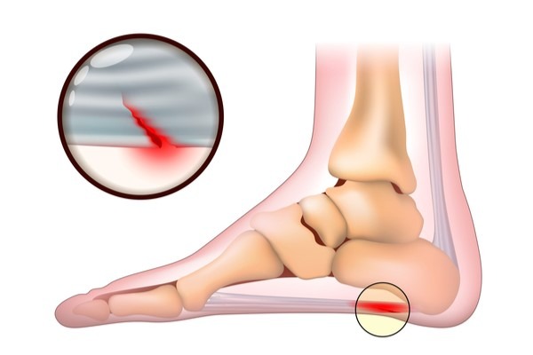 足底筋膜の構造